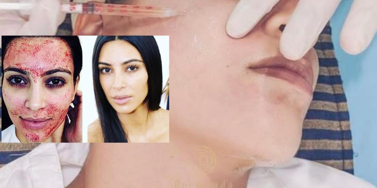 Dermand Clinic تقدم تقنية الـPRP بجودة عالية واهتمامٍ لا مثيل له